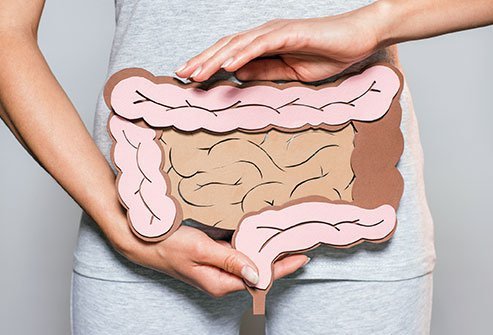 Picture of a Person with Bowel Incontinence