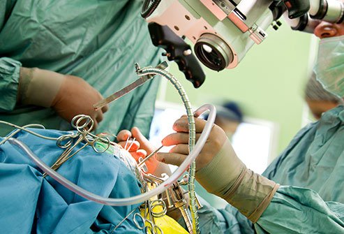 Surgery is often the first step in brain cancer treatment.