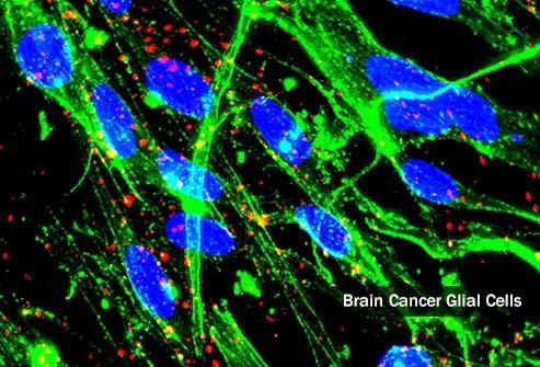 Primary brain tumors start in the brain.