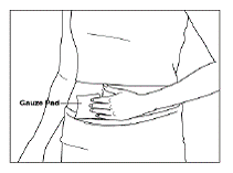 Place a gauze pad over your injection site - Illustration