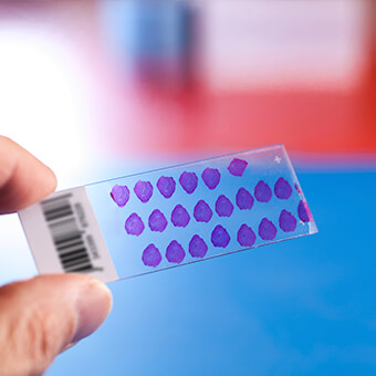 It is the precise diagnosis that determines the recommended treatment.