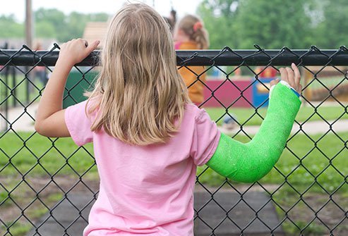 A bone fracture is a broken bone. The four types of bone fractures are a stable fracture, a compound fracture, a transverse fracture and an oblique fracture. 