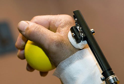 Severe bone breaks may require complex treatment.