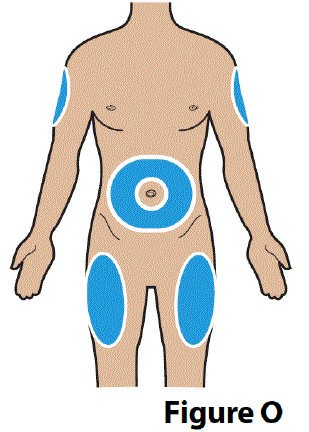 Choose an injection site - Illustration