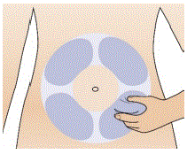 Use your other hand to insert the needle all the way into your skin fold at a 45 to 90-degree angle - Illustration