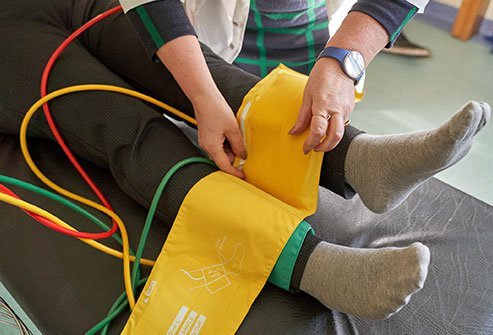 Peripheral arterial disease (PAD)
