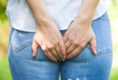 Bleeding hemorrhoids are veins in and around the anus that swell and become irritated. Home care treatment consists of fiber supplements, laxatives, sitz bath, and over-the-counter creams and rectal suppositories. For more severe cases, rubber band ligation, sclerotherapy or surgery to remove may be used.