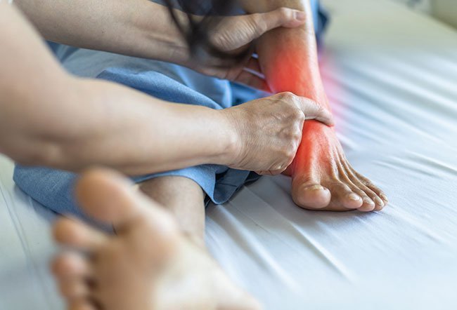 Stress fractures are tiny cracks that develop in the weight-bearing bones.