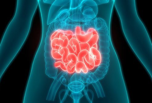 Carcinoid Syndrome (Tumor)