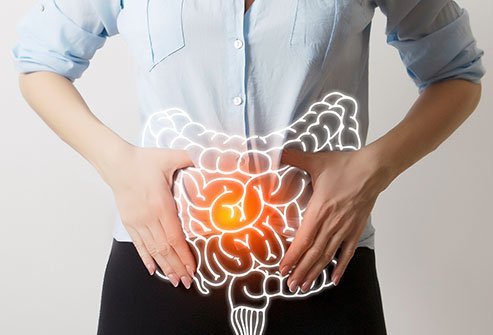 Celiac disease is a digestive intolerance to gluten, which is a common protein found in bread and other wheat products.