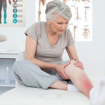 A woman with cellulitis holds her leg while on the medical examination table.