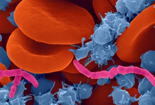See a doctor right away if you suspect you may have cellulitis.