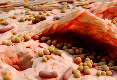 These bacteria live on the skin and in the nose and mouth and do not normally cause problems.