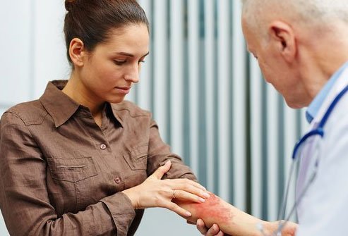 Most cases of cellulitis are mild and a doctor can easily identify what is causing your skin condition.