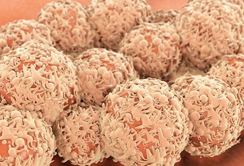Cervical cancer is caused by the human papillomavirus (HPV).