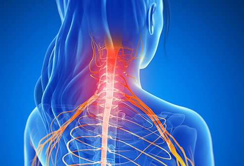 Cervical laminectomy involves surgically removing part or parts of the neck vertebrae to relieve nerve pressure and neck pain. 