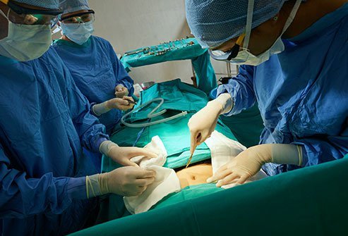 A choledochojejunostomy is a surgical procedure to make a connection (anastomosis) between the common bile duct and the jejunum. This technique is called the Roux-en-Y choledochojejunostomy.