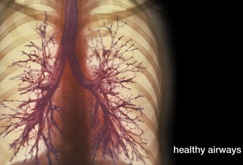 COPD is the abbreviation for chronic obstructive pulmonary disease.