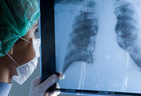 Surgery is not often used to treat people with COPD, but some people may benefit from certain procedures.