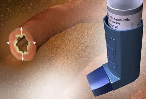 Bronchodilators are medications that are commonly used to treat COPD by relaxing bronchial muscles.