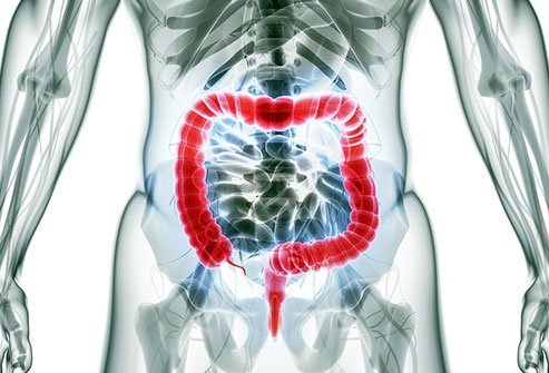 Colon resection surgery (colectomy) removes a length of intestine that is diseased or dead, and then re-connects the severed ends to each other or to an ostomy in the abdomen attached to a colostomy bag to catch feces.