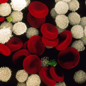 Color enhanced scanning electron micrograph of human blood cells. This sample includes red and white blood cells, and platelets.