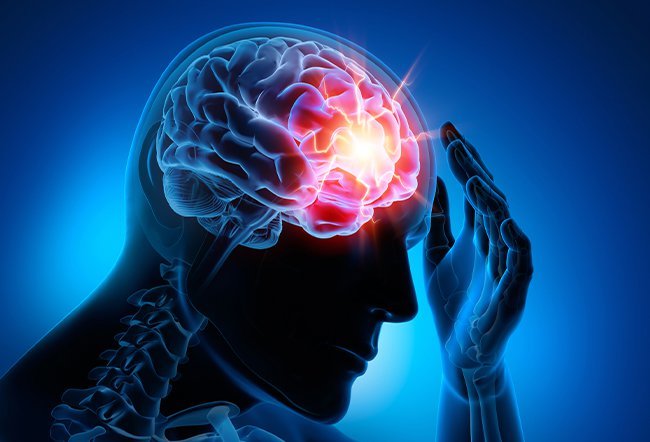 concussion treatment