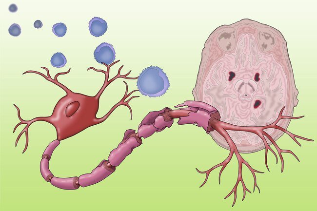 Men experience more severe symptoms of diseases that affect the immune system.