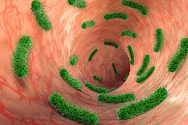 Blood in the urine may occur with a urinary tract infection (UTI).