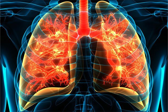 Lung conditions like COPD may be accompanied by shortness of breath, which is also an anxiety symptom.