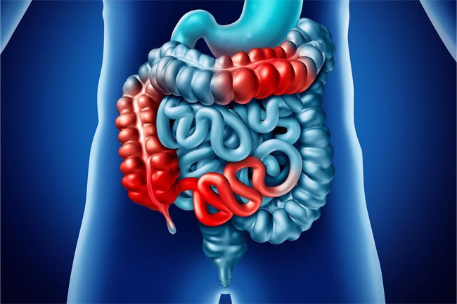 Gastrointestinal symptoms like stomach pains and changes in bathroom habits can trigger anxiety.