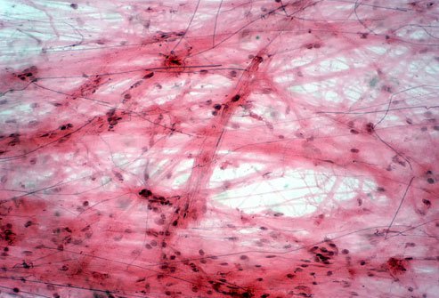 Picture of connective tissue under a microscope.