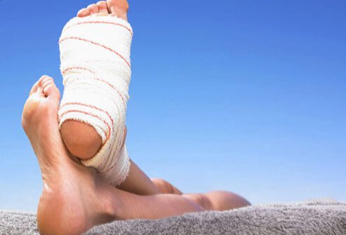 This means raising your injured area. It helps to bring down swelling.