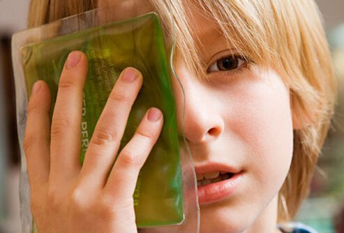 Apply a cold compress or towel-wrapped ice pack for 20 minutes every hour while you’re awake.
