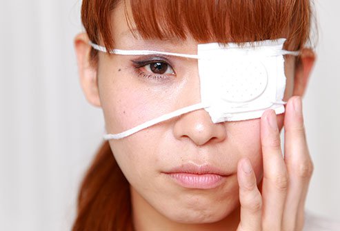 A corneal abrasion occurs when the cornea gets scratched