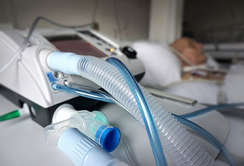 Ventilator Management