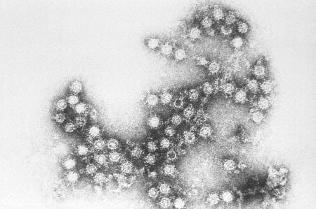 Picture of the Coxsackie virus
