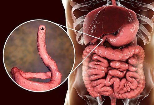 You can pick up hookworm by walking barefoot on soil that has the organism.