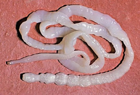 Infected meat may harbor tapeworms.