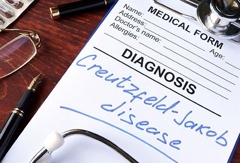 The cause of CJD and other TSE diseases is due to the abnormality of a protein called a prion.