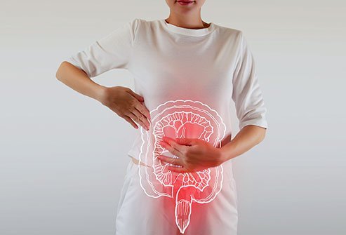 Crohn's disease