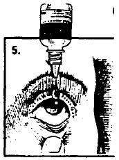 Place dropper tip as close as possible to the lower eyelid and gently squeeze - Illustration