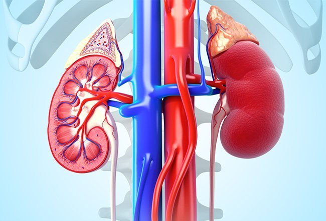 Renal cell carcinoma