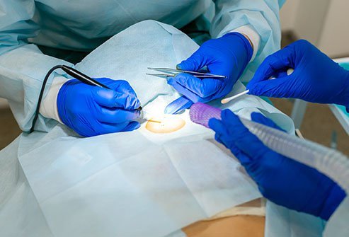 VBAC stands for vaginal birth after cesarean.