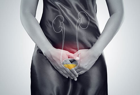 Cystocele is the prolapse of the bladder. 