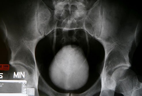 Cystography is the radiological examination of the bladder