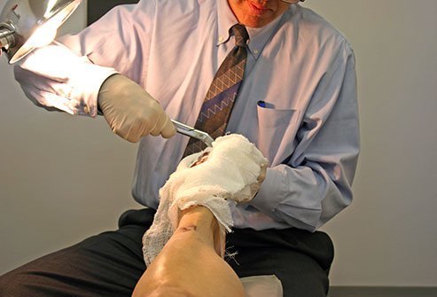 A deep peroneal nerve block is an anesthetic injection to numb the foot for surgical procedures.