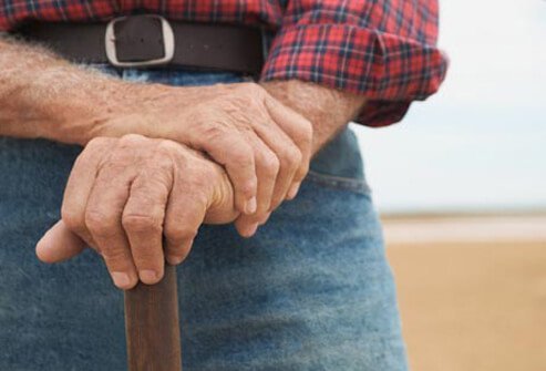 Once a blood clot is gone, DVT sometimes leaves behind an unpleasant reminder.