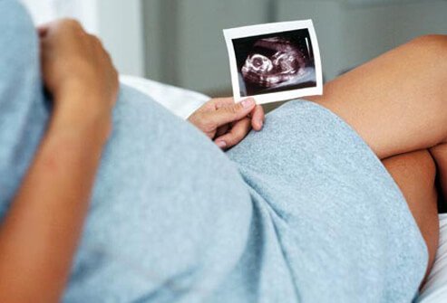 Photo of pregnant woman with an ultrasound picture.