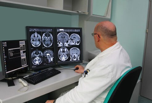 A doctor studies MRI scans of a dementia patient.